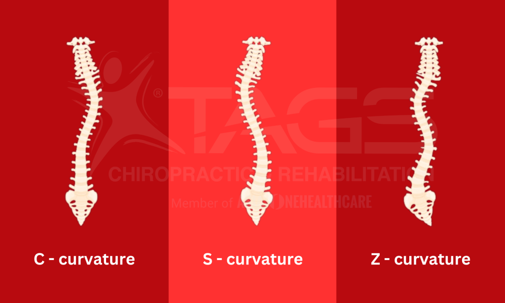 C,S,Z - Curvature Type