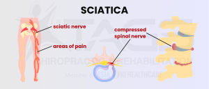 Back knee pain 3