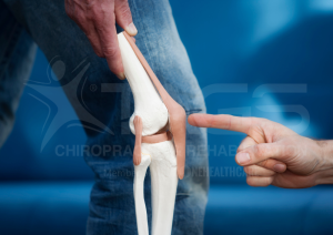 Knee 1