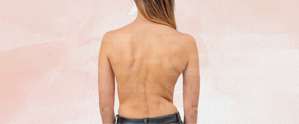 Scoliosis